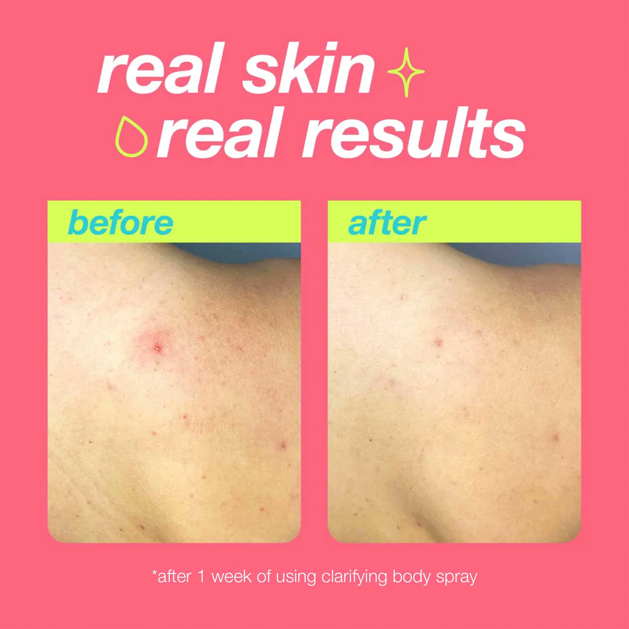 Clarifying Body Spray - Image 3