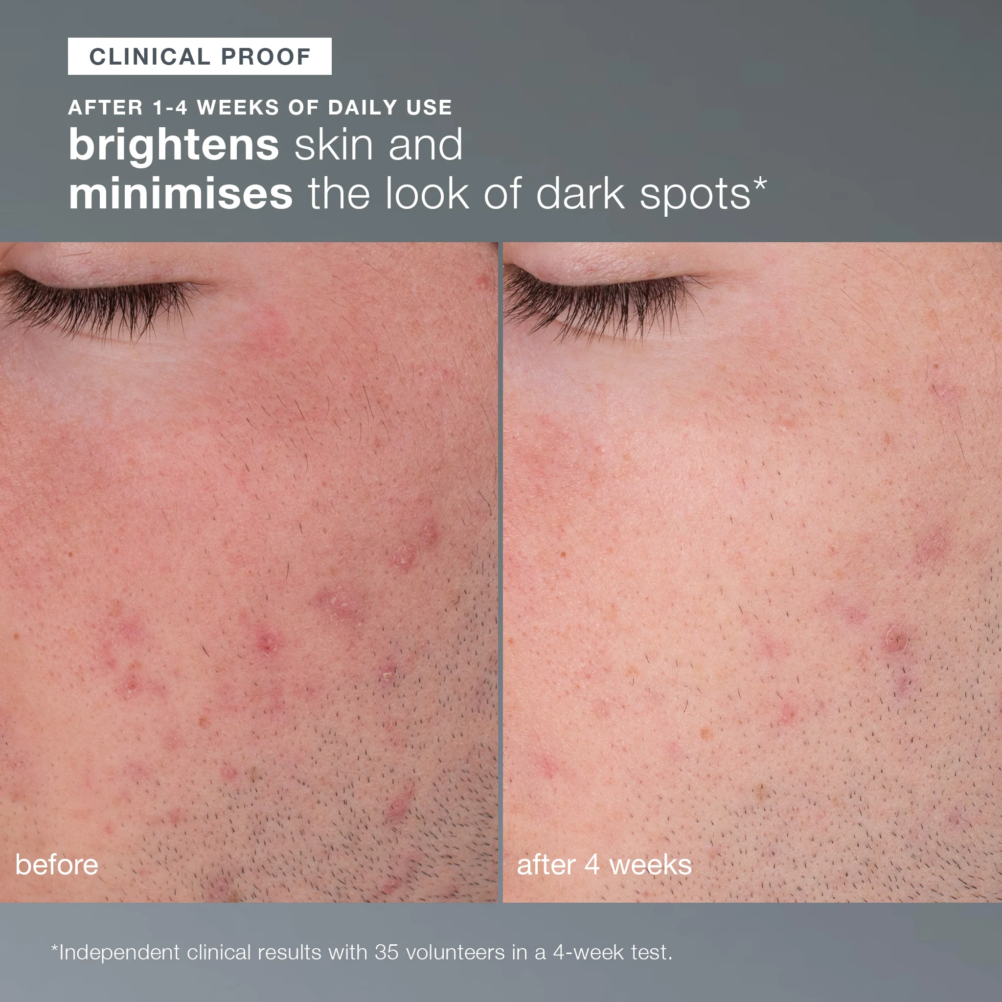 Daily Microfoliant Gentle Exfoliator Powder with Salicylic Acid - Image 9