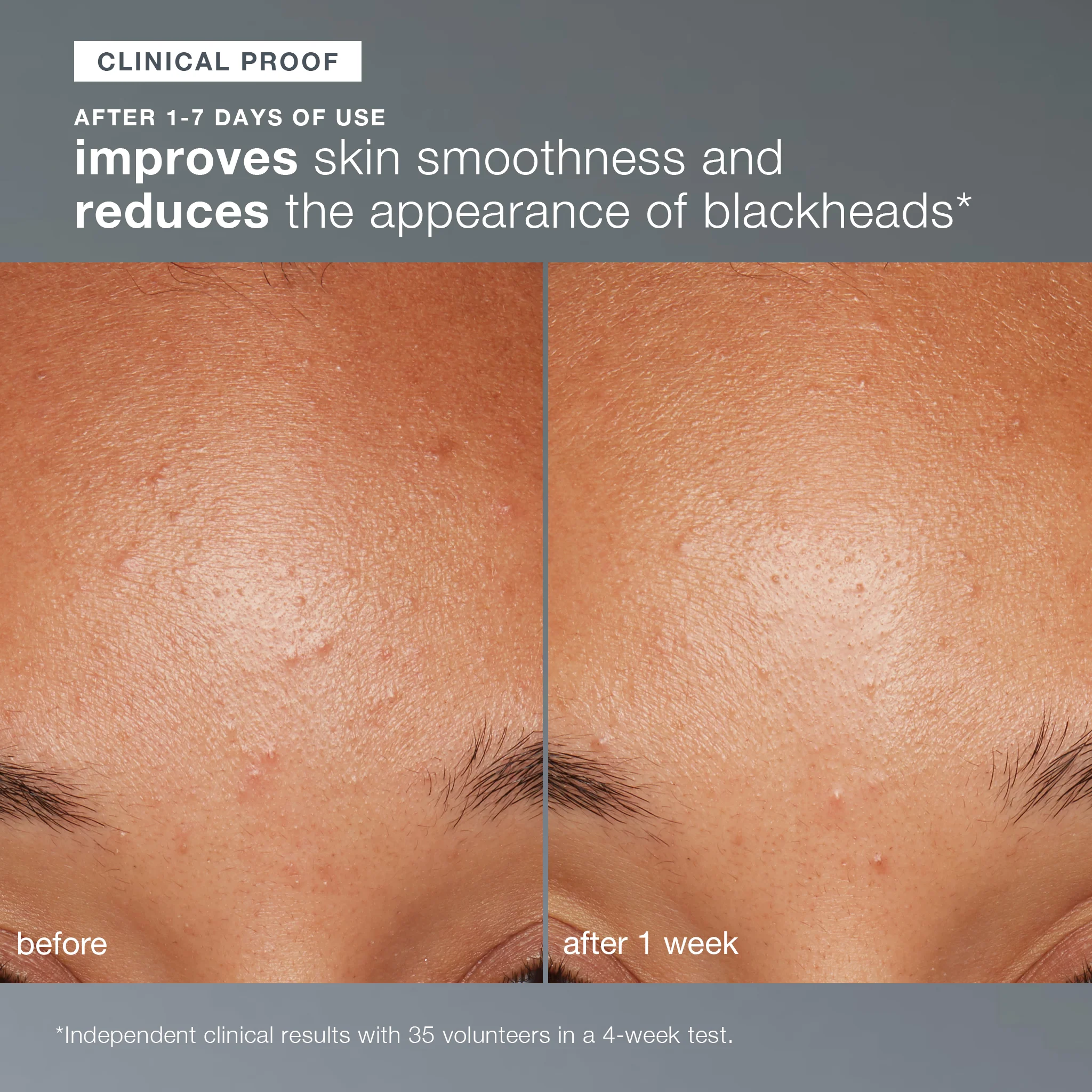 Daily Microfoliant Gentle Exfoliator Powder with Salicylic Acid - Image 8