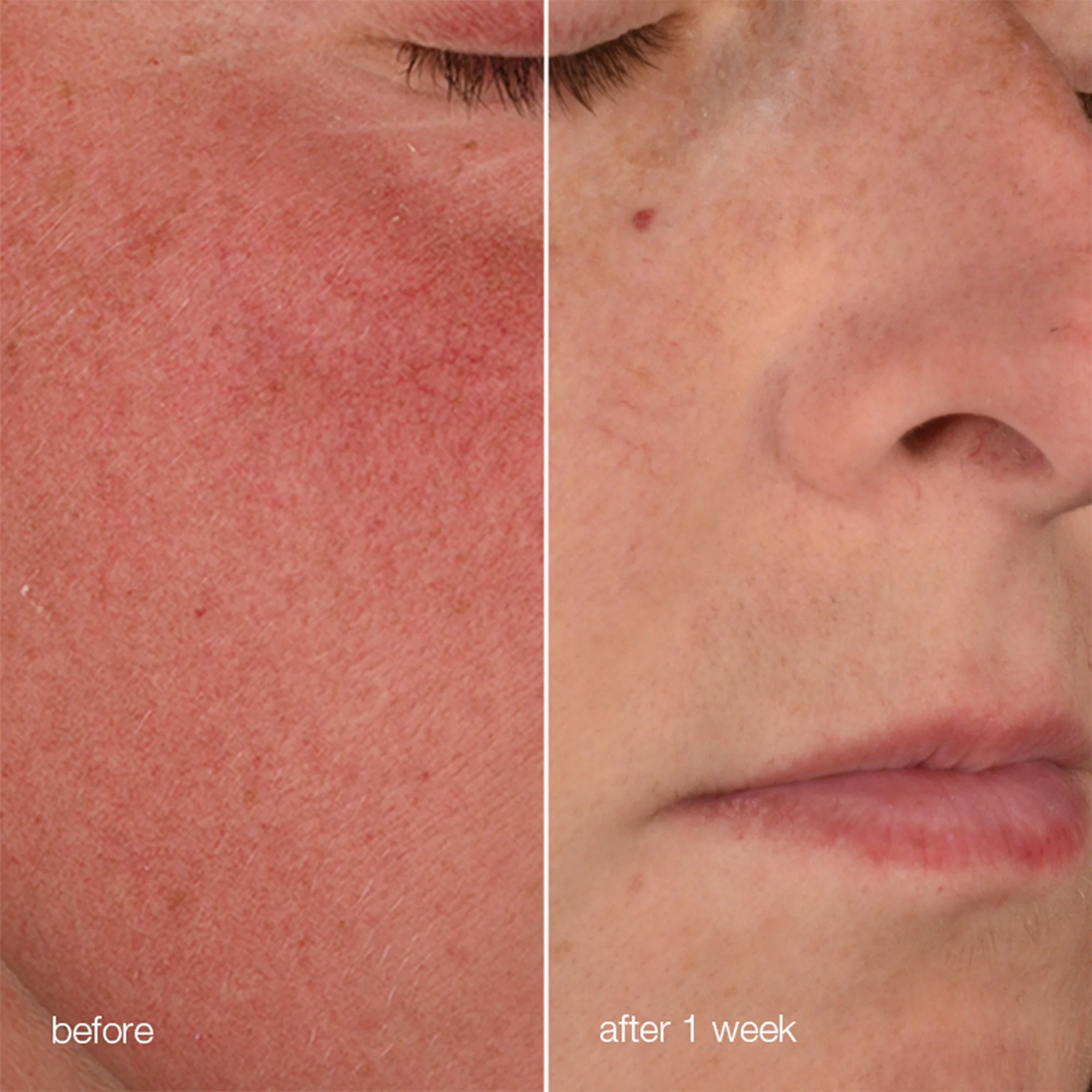 Stabilizing Repair Cream - Image 4